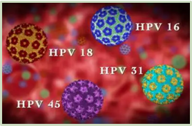 HPV病毒抗原